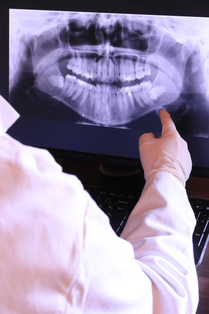 Best Broken or Cracked Tooth Emergency Dentist in Escondido, CA